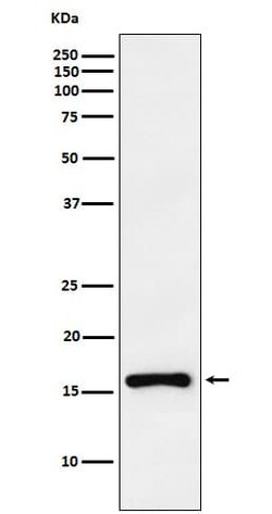 p18INK4c/CDKN2C Antibody (SR1208), Novus Biologicals 50 &mu;g; Unconjugated:Antibodies,