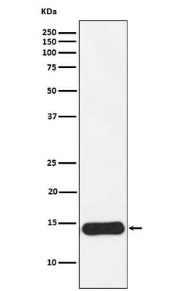 CRABP1 Antibody (SR1172), Novus Biologicals:Antibodies:Primary Antibodies