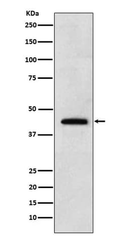 Renalase Antibody (SR1720), Novus Biologicals 50 &mu;g; Unconjugated:Antibodies,