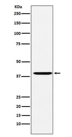 CapG Antibody (SR1632), Novus Biologicals 50 &mu;g; Unconjugated:Antibodies,