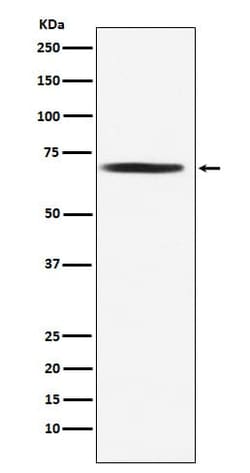 Pyruvate Dehydrogenase E2 Antibody (SR2133), Novus Biologicals 50 &mu;g;