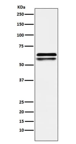 NAP1L1 Antibody (SR1910), Novus Biologicals 50 &mu;g; Unconjugated:Antibodies,