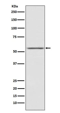 MIS RII/AMHR2 Antibody (SR1978), Novus Biologicals:Antibodies:Primary Antibodies