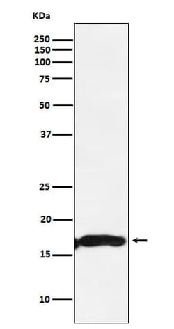 AlphaA Crystallin/CRYAA Antibody (SR1256), Novus Biologicals:Antibodies:Primary