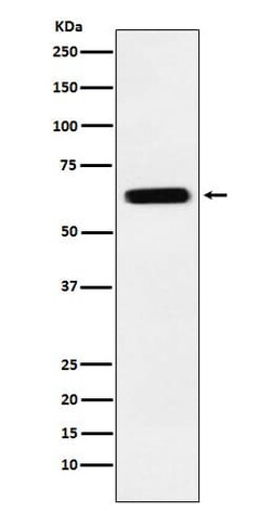 CRMP5 Antibody (SR2071), Novus Biologicals 100 &mu;g | Buy Online | Novus Biologicals | Fisher Scientific