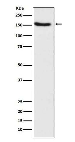 TSC1 Antibody (SR1192), Novus Biologicals:Antibodies:Primary Antibodies