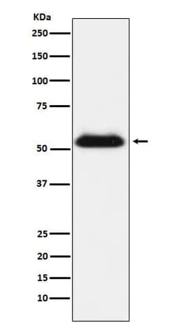 TMPRSS2 Antibody (SR1968), Novus Biologicals 100 &mu;g; Unconjugated:Antibodies,