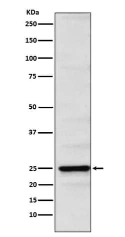 Neurogenin-2 Antibody (SR1400), Novus Biologicals:Antibodies:Primary Antibodies