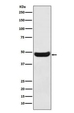 BHMT Antibody (SR1760), Novus Biologicals:Antibodies:Primary Antibodies
