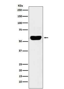 Salivary Amylase Alpha Antibody (SR2033), Novus Biologicals 100 &mu;g;