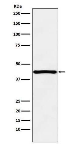 HOXA13 Antibody (SR1709), Novus Biologicals 100 &mu;g; Unconjugated:Antibodies,