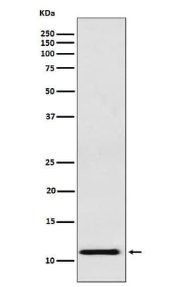 Fetal Hemoglobin Antibody (SR1113), Novus Biologicals 50 &mu;g; Unconjugated:Antibodies,