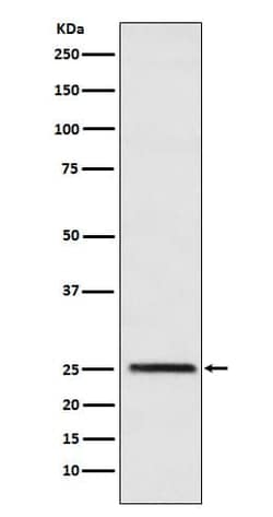 Triosephosphate isomerase Antibody (SR1406), Novus Biologicals 100 &mu;g;