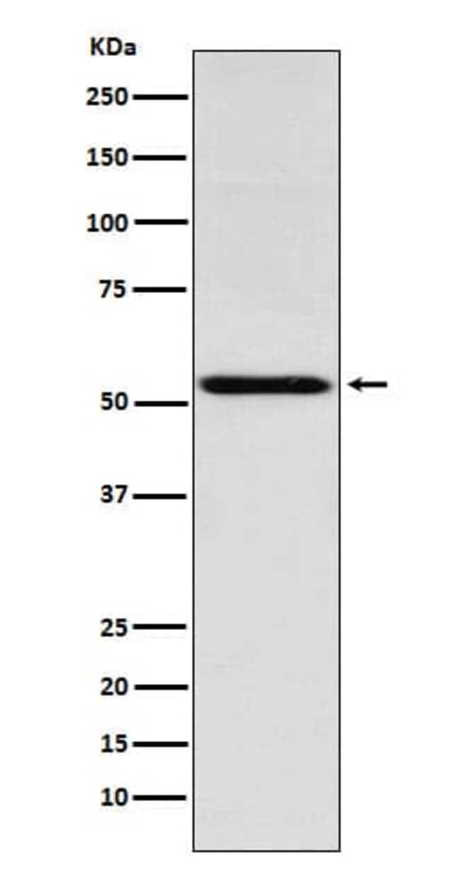 TR alpha/NR1A1/Thyroid Hormone Receptor alpha Antibody (SR2000), Novus