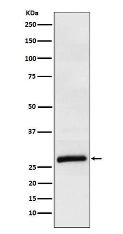 Apolipoprotein M/ApoM Antibody (SR1390), Novus Biologicals 100 &mu;g; Unconjugated:Antibodies,