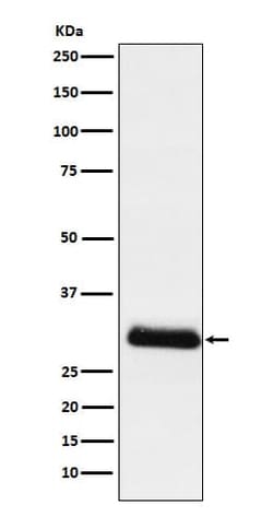 Apolipoprotein D Antibody (SR1458), Novus Biologicals 100 &mu;g; Unconjugated:Antibodies,