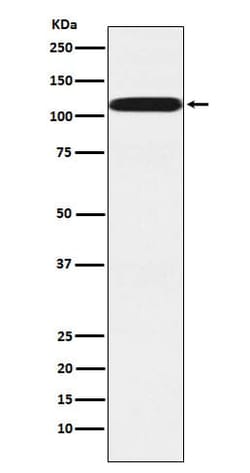 PUM2 Antibody (SR1070), Novus Biologicals 50 &mu;g; Unconjugated:Antibodies,