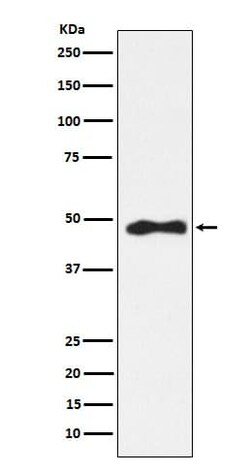 AP2 alpha Antibody (SR1826), Novus Biologicals:Antibodies:Primary Antibodies