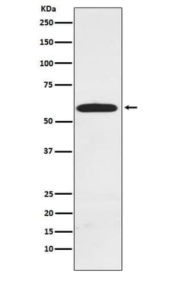 HR23A/Rad23A TUBE1 Antibody (SR1997), Novus Biologicals:Antibodies:Primary