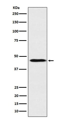 Apolipoprotein A-IV/ApoA4 Antibody (SR1758), Novus Biologicals 100 &mu;g;