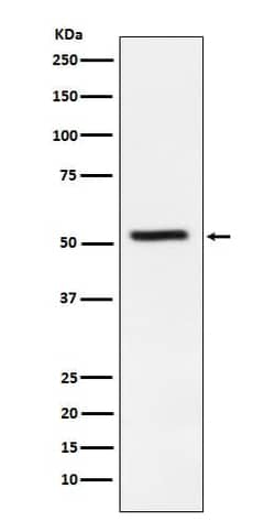 Tryptophanyl tRNA synthetase Antibody (SR1950), Novus Biologicals:Antibodies:Primary