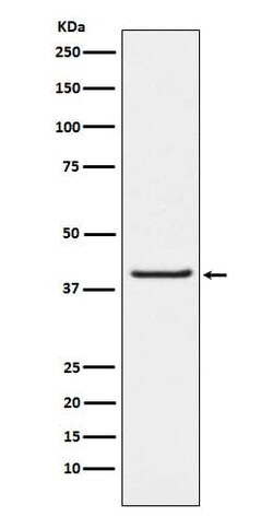 PAWR Antibody (SR1674), Novus Biologicals 100 &mu;g; Unconjugated:Antibodies,