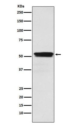 Muscarinic Acetylcholine Receptor M2/CHRM2 Antibody (SR1913), Novus Biologicals