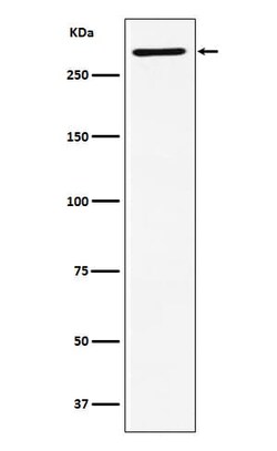 UBR5/EDD Antibody (SR1501), Novus Biologicals:Antibodies:Primary Antibodies