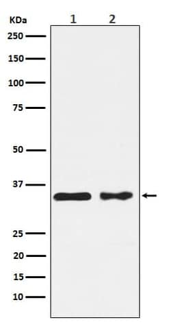 Casein Kinase 1 alpha Antibody (SR1581), Novus Biologicals 50 &mu;g; Unconjugated:Antibodies,