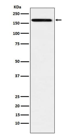 IL-17RA/IL-17R Antibody (SR1226), Novus Biologicals:Antibodies:Primary