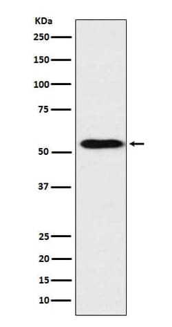 Apolipoprotein H/ApoH Antibody (SR1979), Novus Biologicals:Antibodies:Primary