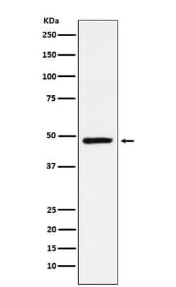 TLX/NR2E1 Antibody (SR1840), Novus Biologicals 50 &mu;g; Unconjugated:Antibodies,