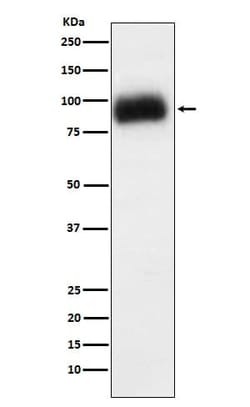 ADAM15 Antibody (SR2269), Novus Biologicals:Antibodies:Primary Antibodies