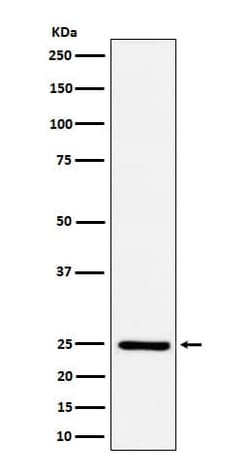 Ephrin-A1 Antibody (SR1377), Novus Biologicals 100 &mu;g; Unconjugated:Antibodies,