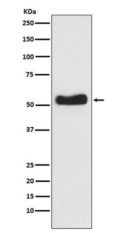 Glucokinase/GCK Antibody (SR1917), Novus Biologicals:Antibodies:Primary