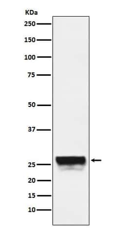 Chymotrypsin-like protease Antibody (SR1373), Novus Biologicals:Antibodies:Primary