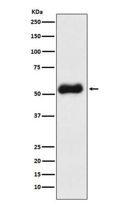 Thromboxane synthase Antibody (SR1967), Novus Biologicals:Antibodies:Primary