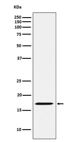 FHIT Antibody (SR1259), Novus Biologicals:Antibodies:Primary Antibodies