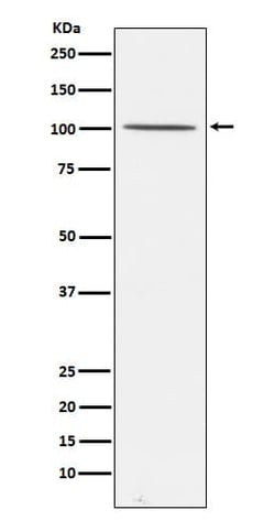 Gemin 3 Antibody (SR1015), Novus Biologicals:Antibodies:Primary Antibodies
