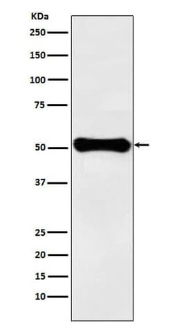 Glutamate Dehydrogenase Antibody (SR1881), Novus Biologicals 100 &mu;g;