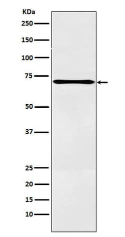 12-Lipoxygenase Antibody (SR2151), Novus Biologicals:Antibodies:Primary