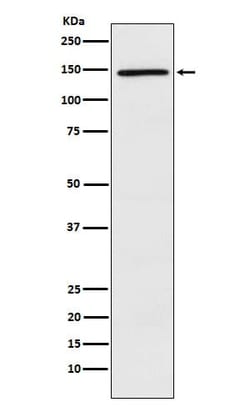 PLC-gamma 2 Antibody (SR1168), Novus Biologicals:Antibodies:Primary Antibodies