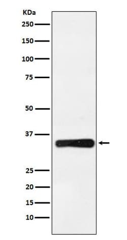 HOXB4 Antibody (SR1562), Novus Biologicals 100 &mu;g | Buy Online | Novus Biologicals | Fisher Scientific