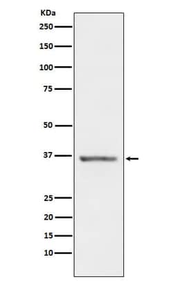 Stanniocalcin 1/STC-1 Antibody (SR1521), Novus Biologicals 50 &mu;g; Unconjugated:Antibodies,