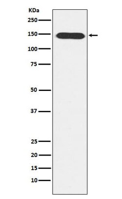 PLC-beta 3 Antibody (SR1198), Novus Biologicals 50 &mu;g; Unconjugated:Antibodies,