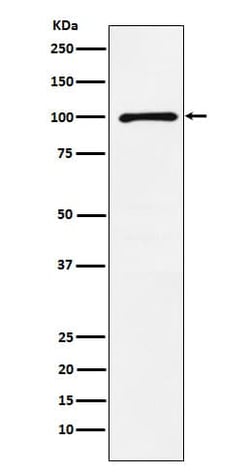 Glutamate Receptor 6 Antibody (SR1029), Novus Biologicals 50 &mu;g; Unconjugated:Antibodies,