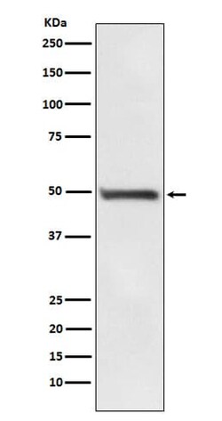 RAD52 Antibody (SR1844), Novus Biologicals 50 &mu;g; Unconjugated:Antibodies,