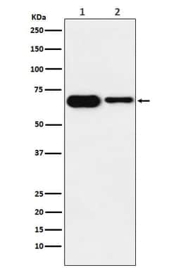 IMP2/IGF2BP2 Antibody (SR2106), Novus Biologicals 100 &mu;g; Unconjugated:Antibodies,