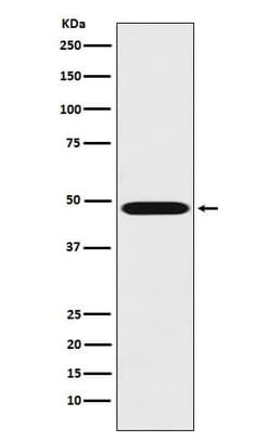 Renin Antibody (SR1820), Novus Biologicals 100 &mu;g; Unconjugated:Antibodies,