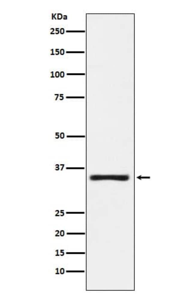 Kallikrein 2 Antibody (SR1547), Novus BiologicalsAntibodiesPrimary